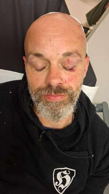 Uetze: Polizei jagt Messerstecher nach Angriff auf Rivalen