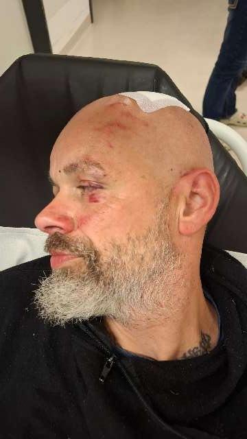 Uetze: Polizei jagt Messerstecher nach Angriff auf Rivalen